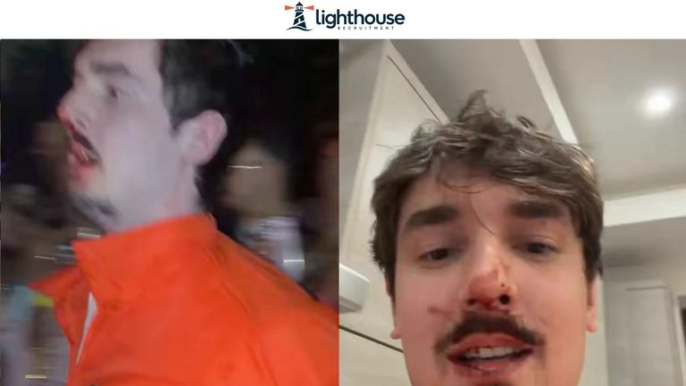 Bryce Hall Left Bloodied After Violent Fight Outside N3on’s Halloween Party